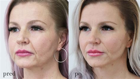 Ukážka pred a po aplikácii Brow BioHenny