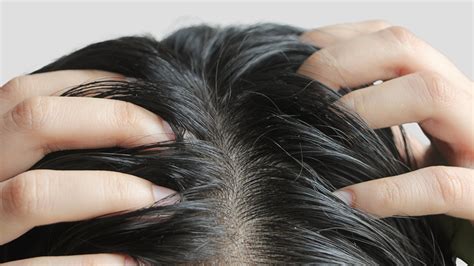 zdravá pokožka hlavy