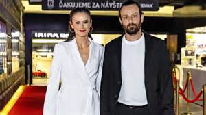 Robo Jakab pred a po zmene účesu