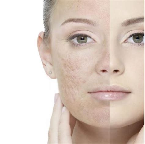 Zdravá vlasová pokožka bez lupín