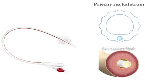 typy ručných žiletiek pre ženy