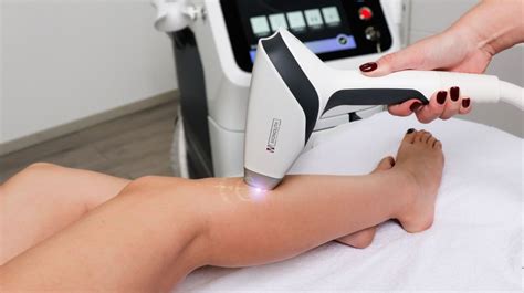 Princíp laserovej epilácie