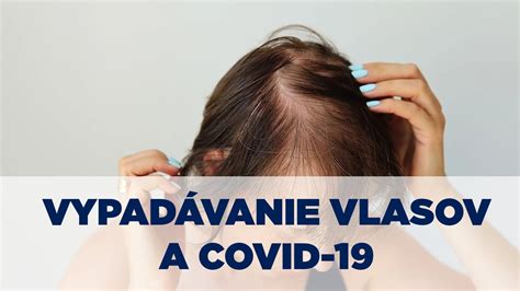 Rôzne typy vypadávania vlasov