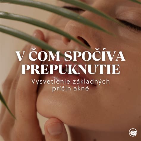 Prehľad typov a príčin akné