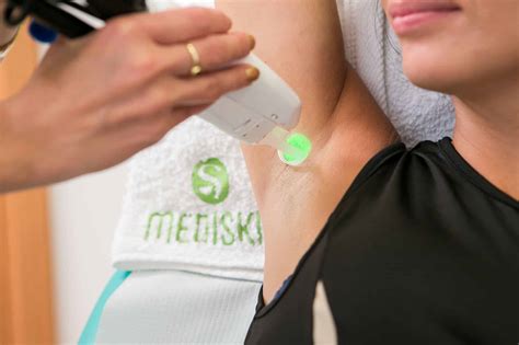 Pokožka po laserovej epilácii a starostlivosť o ňu