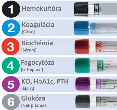 ilustračné foto odberu krvi v laboratóriu