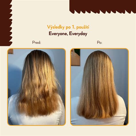 Typy vlasov a ich potreby