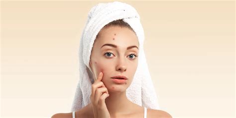 Žena s nadmerným ochlpením