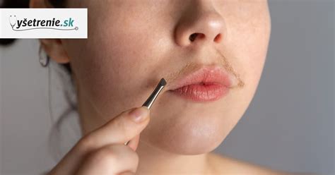 Detailná schéma typov ochlpenia na ženskej tvári