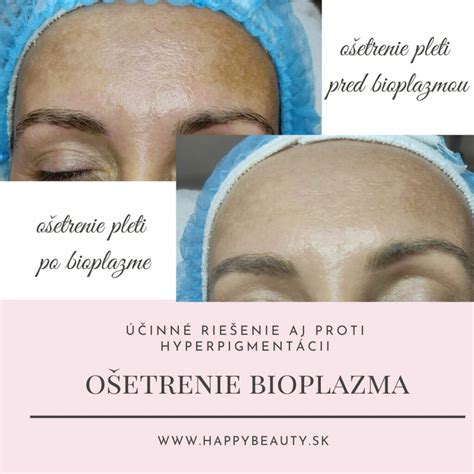 ukážka kozmetického ošetrenia pleti