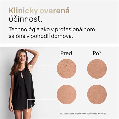 Správne odtiene pokožky pre použitie IPL